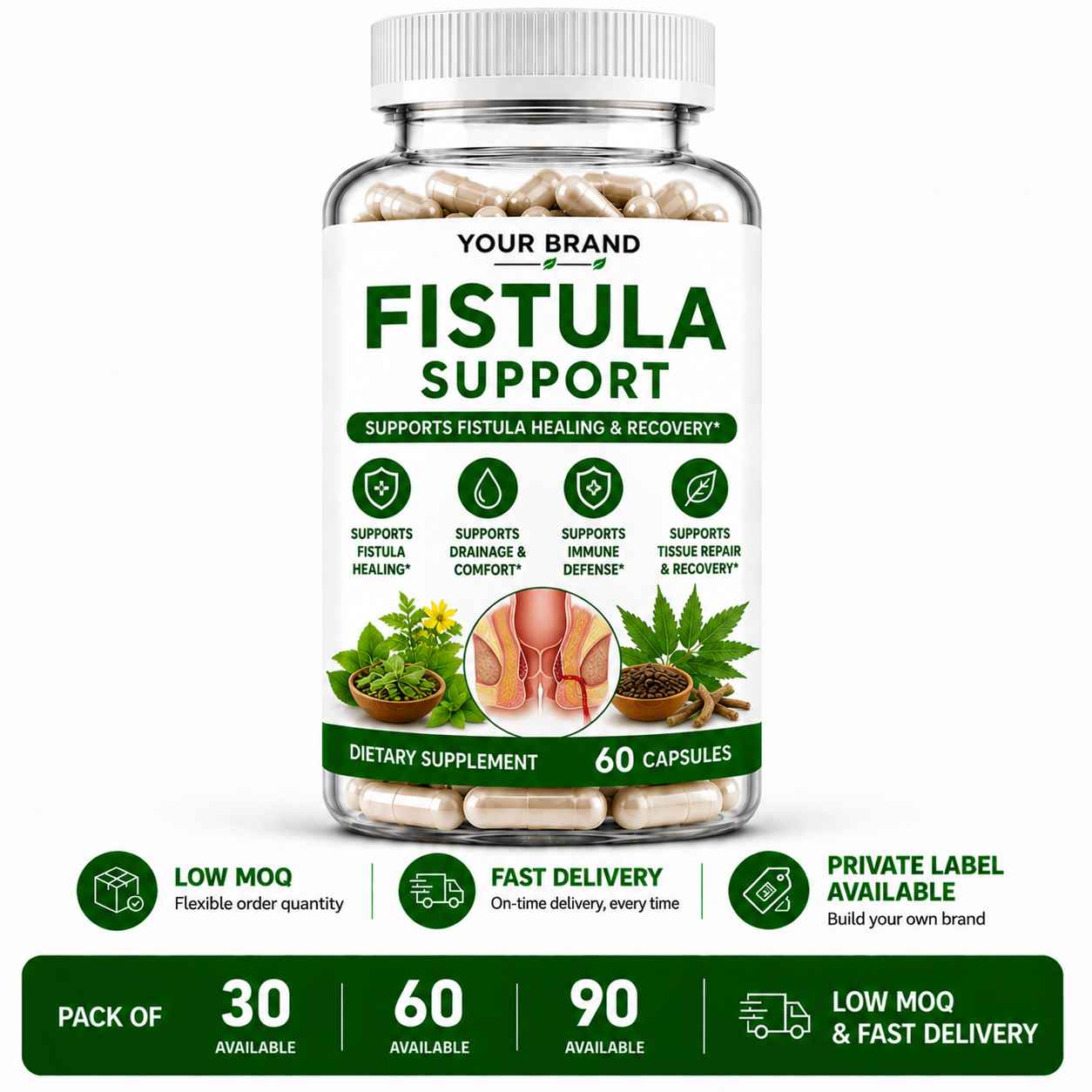 Fistula